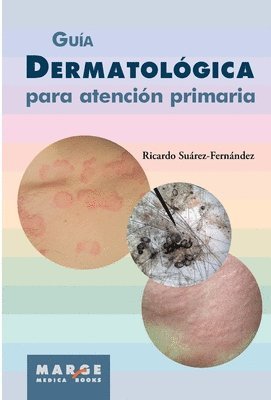 bokomslag Gua dermatolgica para atencin primaria