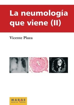 neumología que viene II 1