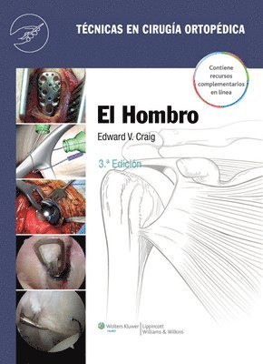 El hombro