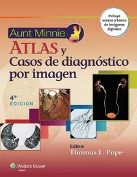 bokomslag Aunt Minnie. Atlas y casos de diagnstico por imagen