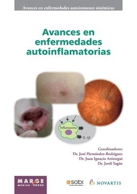 bokomslag Avances en enfermedades autoinflamatorias