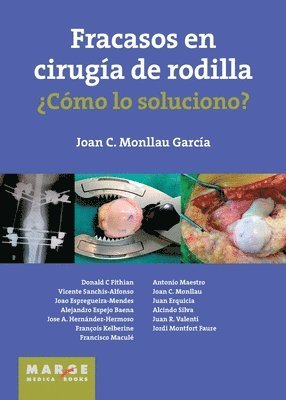 Juan C Monllau García, Juan C. Monllau García - Fracasos en cirugía de rodilla ¿Cómo lo soluciono?, Häftad