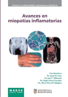 bokomslag Avances en miopatías inflamatorias