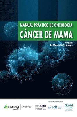 Miguel Martín Jiménez - Manual Práctico de Oncología - Cáncer de Mama, Inbunden