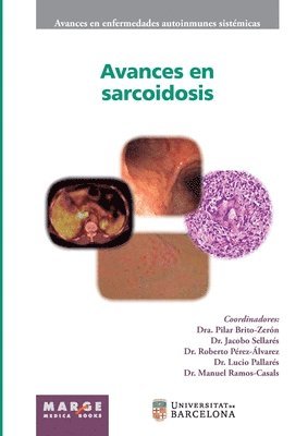 bokomslag Avances en sarcoidosis