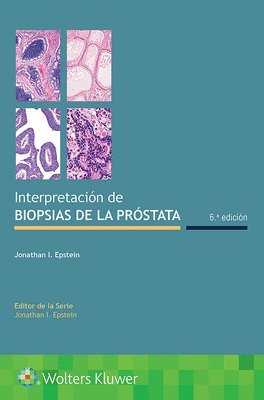 bokomslag Interpretacin de biopsias de la prstata