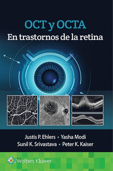 bokomslag OCT y OCTA en trastornos de la retina