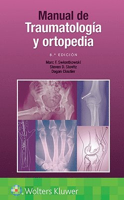 Manual de traumatologa y ortopedia 1