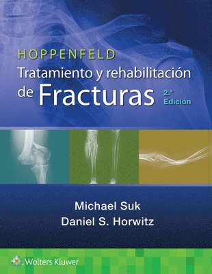 Hoppenfeld. Tratamiento y rehabilitacin de fracturas 1