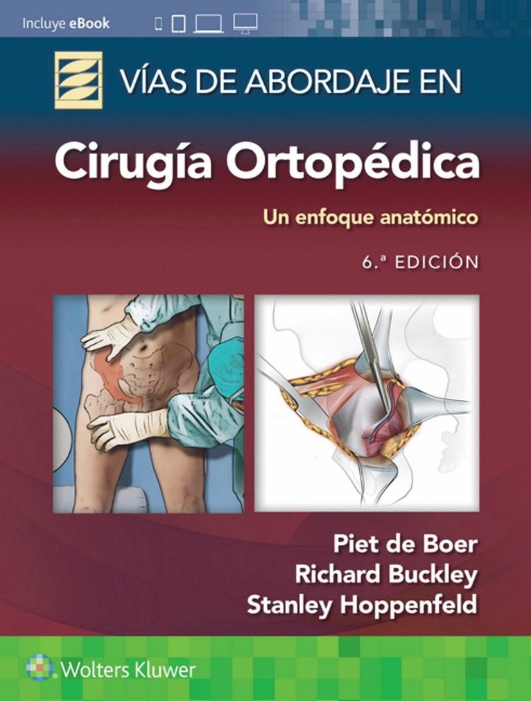 Piet de Boer, Richard Buckley, Stanley Hoppenfeld, MD de Boer, Dr. Piet, FRCSC Buckley, Richard, MD, Piet De Boer - Vías de abordaje de cirugía ortopédica. Un enfoque anatómico, Häftad