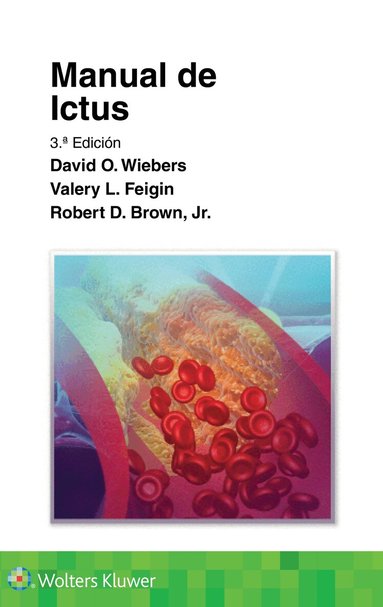 David O. Wiebers, Valery L. Feigin, Robert D. Brown, Jr. - Manual de ictus, Häftad