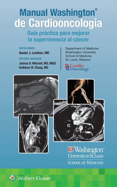 Daniel Lenhan, Kathleen W. Zhang, Joshua Mitchell, - Manual Washington de Cardiooncología, Häftad