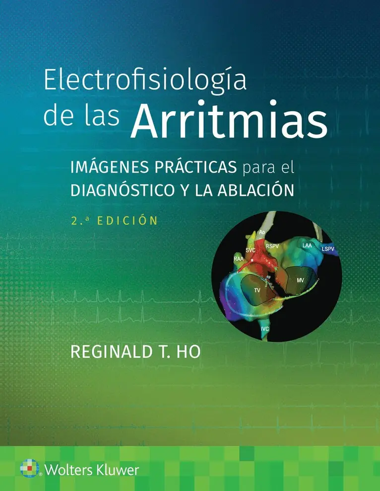 Reginald T. Ho - Electrofisiología de las arritmias, Häftad. Tillgänglighet: Lägg i varukorg