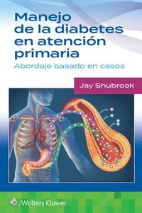 bokomslag Manejo de la diabetes en Atencin primaria. Abordaje basado en casos