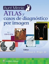 bokomslag Aunt Minnie. Atlas y casos de diagnstico por imagen