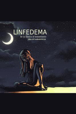 Linfedema: de la Clínica Al Tratamiento 1