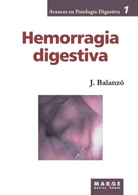 Hemorragia digestiva 1
