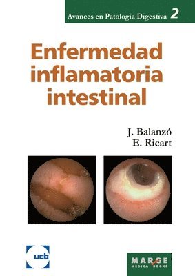 Enfermedad inflamatoria intestinal 1