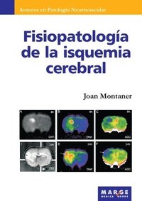 bokomslag Fisiopatologa de la isquemia cerebral