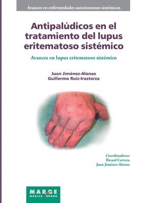 Guillermo Ruíz Irastorza, Juan Jiménez Alonso - Antipalúdicos en el tratamiento del lupus eritematoso sistémico, Häftad