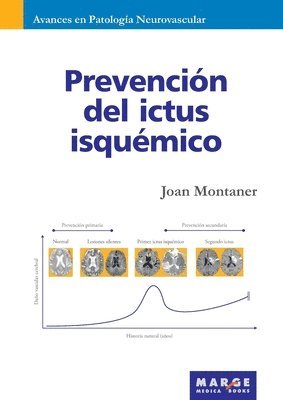 Prevencin del ictus isqumico 1