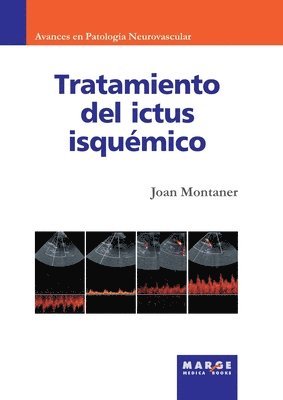 bokomslag Tratamiento del ictus isqumico