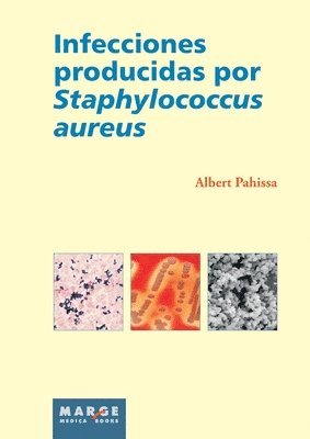 bokomslag Infecciones producidas por Staphylococcus aureus