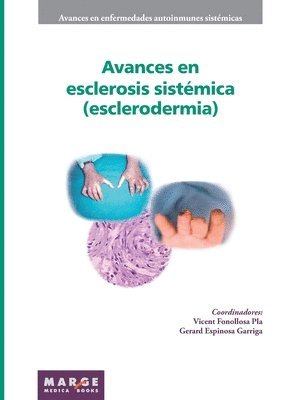 bokomslag Avances en esclerosis sistmica (esclerodermia)