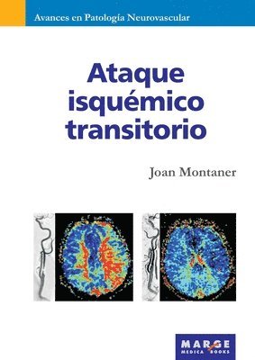 bokomslag Ataque isquémico transitorio