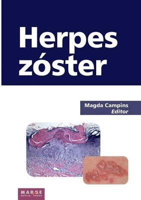 bokomslag Herpes zster