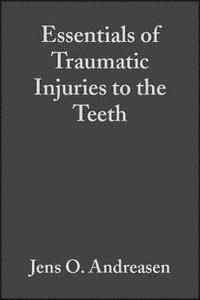 Essentials of traumatic injuries to the teeth - a step-by-step treatment gu