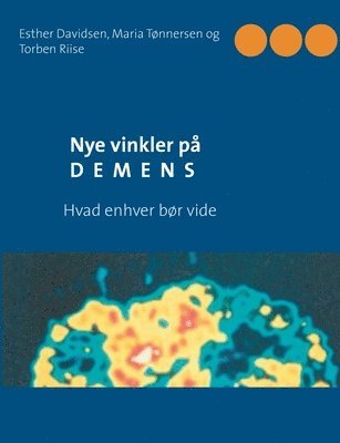 bokomslag Nye vinkler på demens