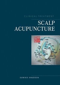 bokomslag Scalp Acupuncture