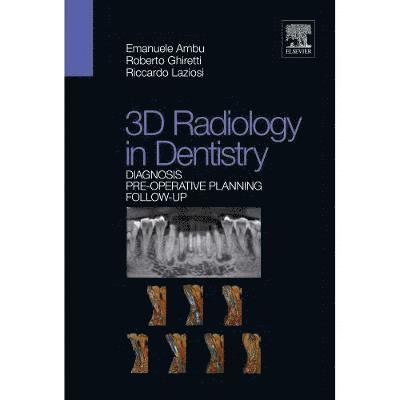 3D radiology in dentistry - Diagnosis Pre-operative Planning Follow-up 1