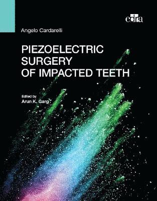 bokomslag Piezoelectric surgery of impacted teeth