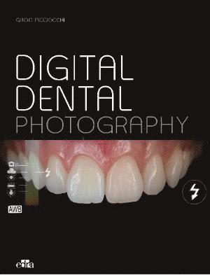 bokomslag Esthetic Implants -How to think about complex cases in anterior - areas with a global approach to the patient smile (2 books)