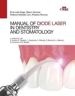 Emanuele Ruga, Marco Garrone, Raffaele Michele Calvi, Roberto Riversa E. Amerio, M. Amoroso, L. Barreiro, A. Etemadi, D. Nocentini, H. Singh Marjara, E. Trevisiol, L. Zamprotta, Raffaele Michele Calvi - Manual of Diode Laser in Dentistry and Stomatology, Inbunden