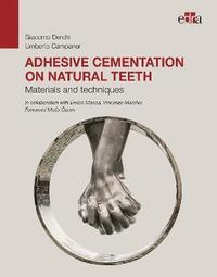 bokomslag Adhesive cementation on natural teeth - Materials and techniques