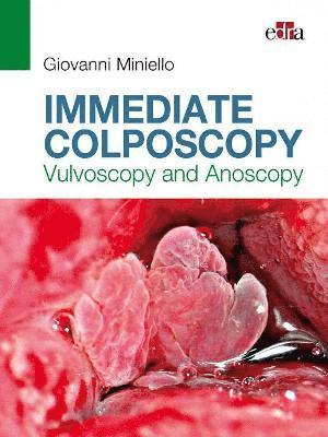 Giovanni Miniello - Immediate Colposcopy - Vulvoscopy and Anoscopy, Häftad