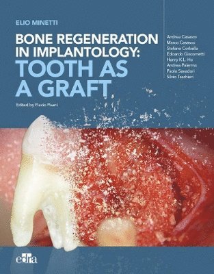 Bone regeneration in implantology - tooth as a graft 1