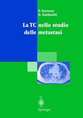 bokomslag La TC nello studio delle metastasi