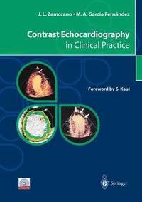bokomslag Contrast Echocardiography in Clinical Practice