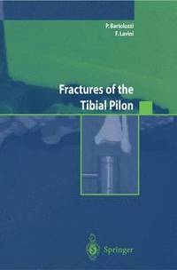 bokomslag Fractures of the Tibial Pilon