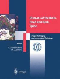 bokomslag Diseases of the Brain, Head and Neck, Spine