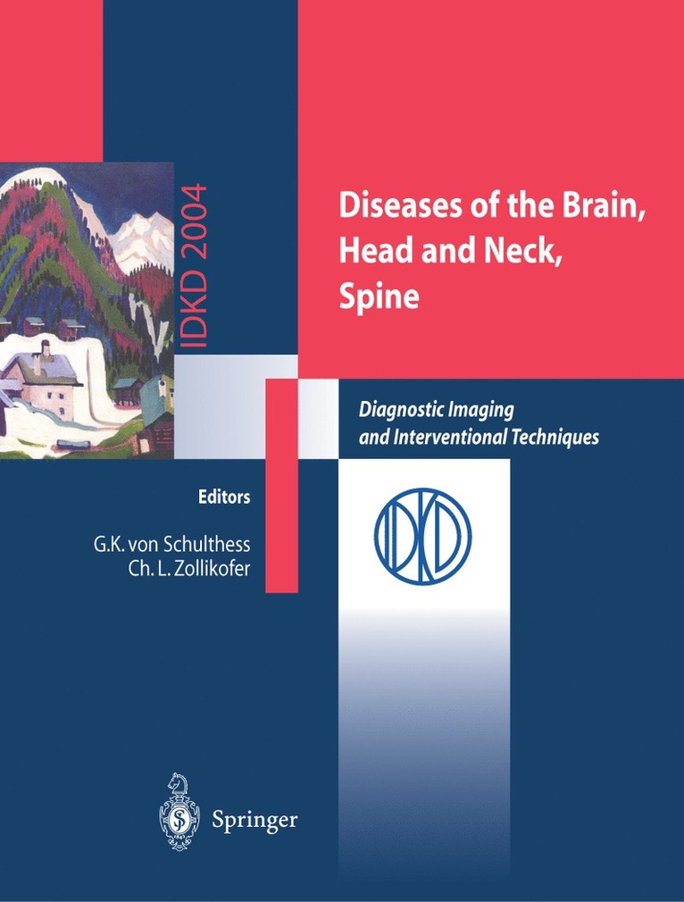 Gustav K. Schulthess, Christoph L. Zollikofer, Gustav K. von Schulthess, Christoph Zollikofer - Diseases of the Brain, Head and Neck, Spine, Häftad