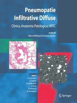 Pneumopatie Infiltrative Diffuse 1
