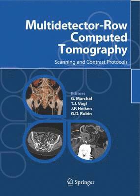 G. Marchal, T.J. Vogl, J P. Heiken, G. D. Rubin, T. J. Vogl - Multidetector-Row Computed Tomography, Inbunden