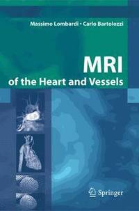 bokomslag MRI of the Heart and Vessels