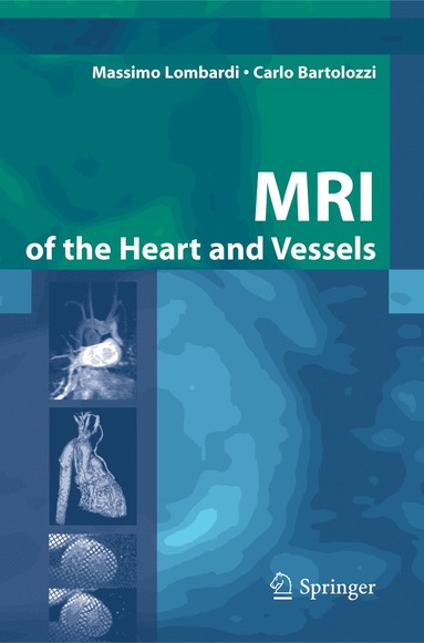 bokomslag MRI of the Heart and Vessels