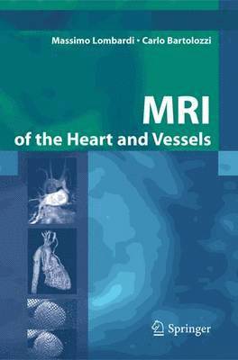 MRI of the Heart and Vessels 1